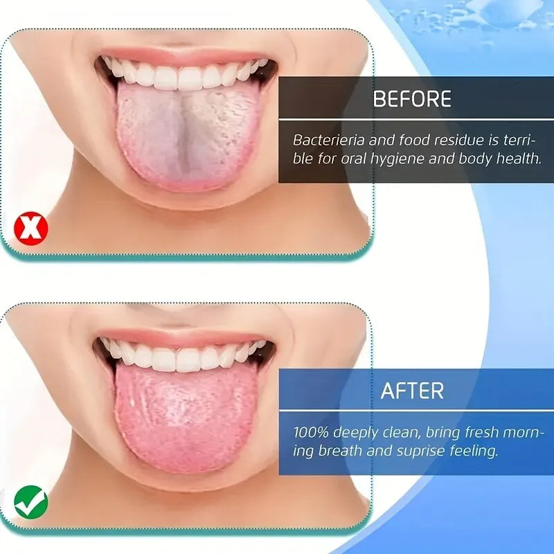 TONGUE SCRAPER